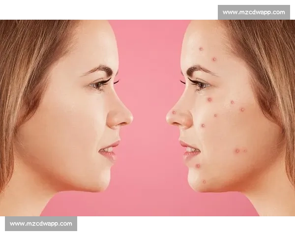 普通皮肤护理指南:保持健康肌肤的日常保养与注意事项 普通皮肤护理指南:保持健康肌肤的日常保养与注意事项